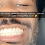 Ola Aina Calls Out Son Heung-min for Breaking His Teeth Before Comedic Twist